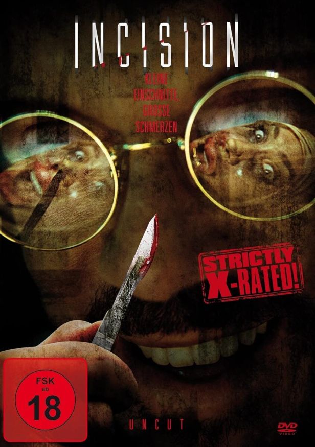 Incision - Kleine Einschnitte, große Schmerzen (1DVD)